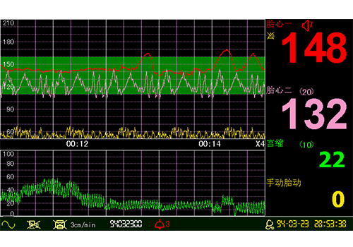 9e9b6272-17f8-47d6-8838-7483b293e371