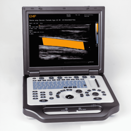 ultrasound scanner
