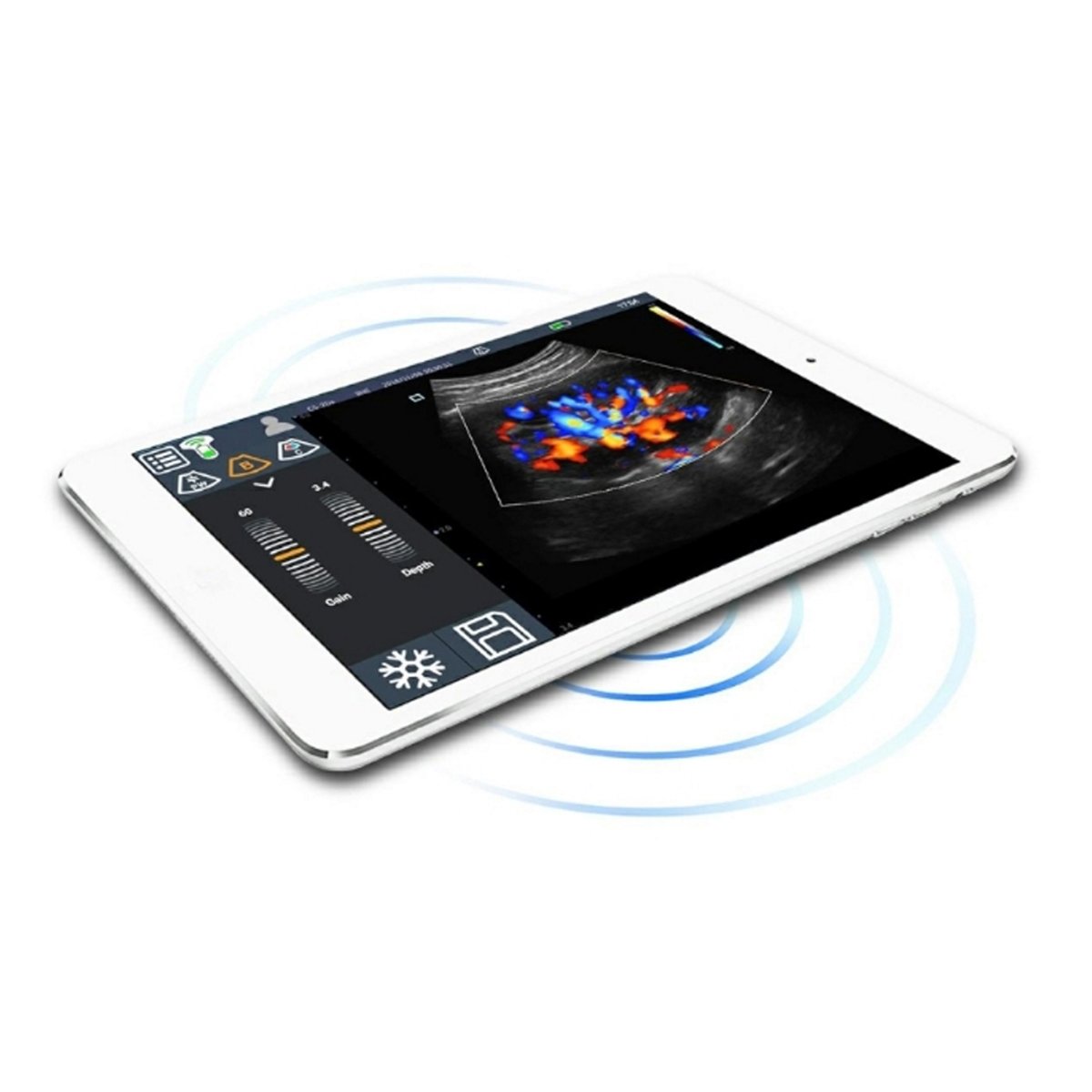 Youkey D8C and B Wifi Ultrasound probes_001 copy