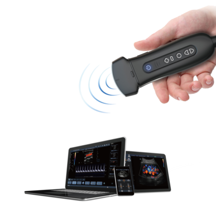 Wireless & Usb Ultrasound Probes-2